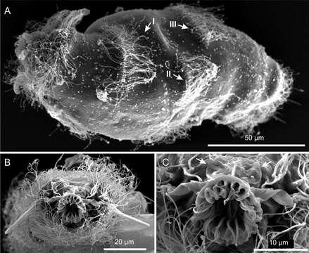 Image of gastrotrichs