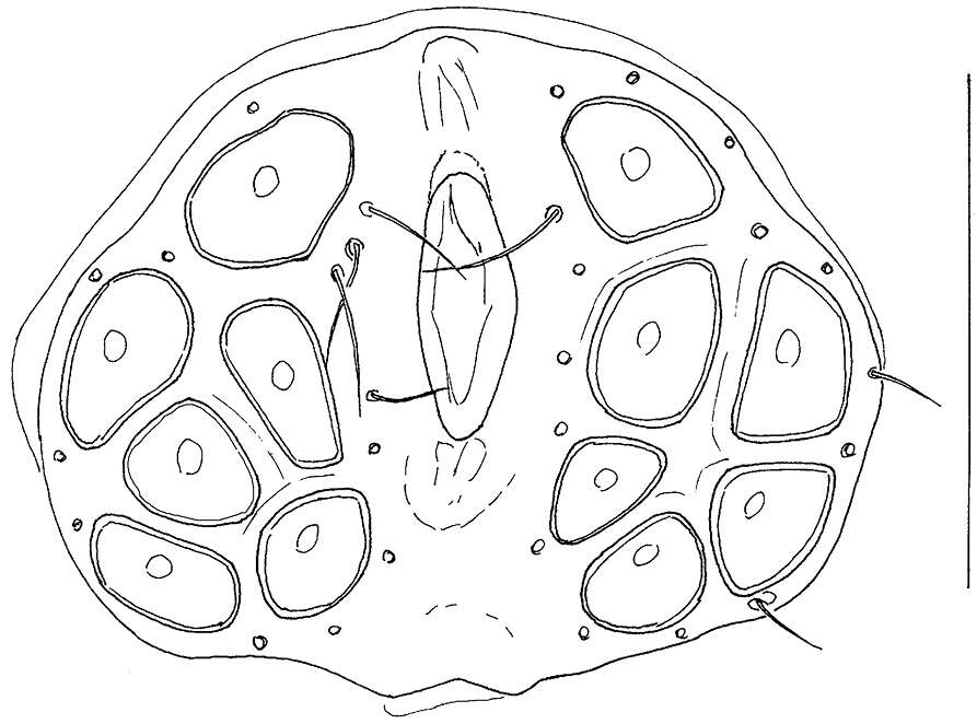 Image of <i>Hygrobates diversiporus</i> Sokolow 1927