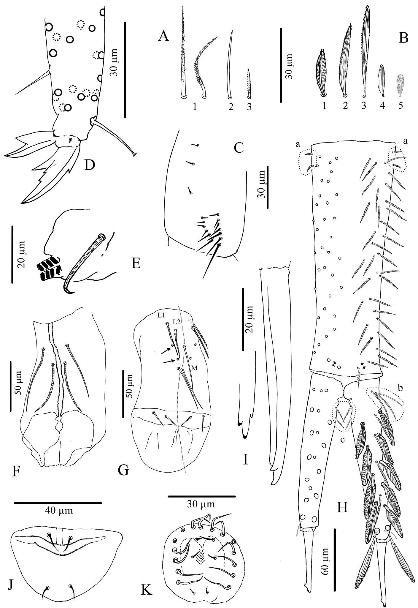 Image de Cyphoderidae