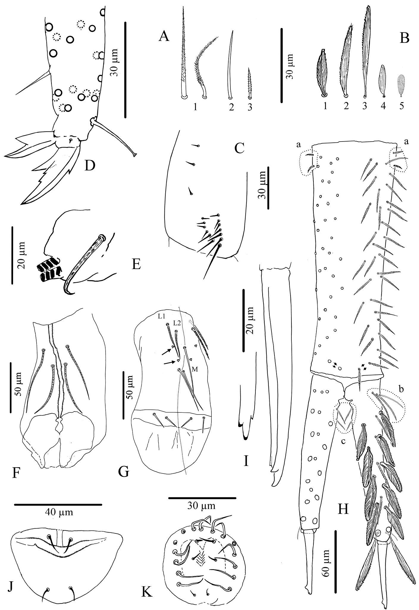 Image of Cyphoderus songkhlaensis Jantarit, Satasook & Deharveng 2014