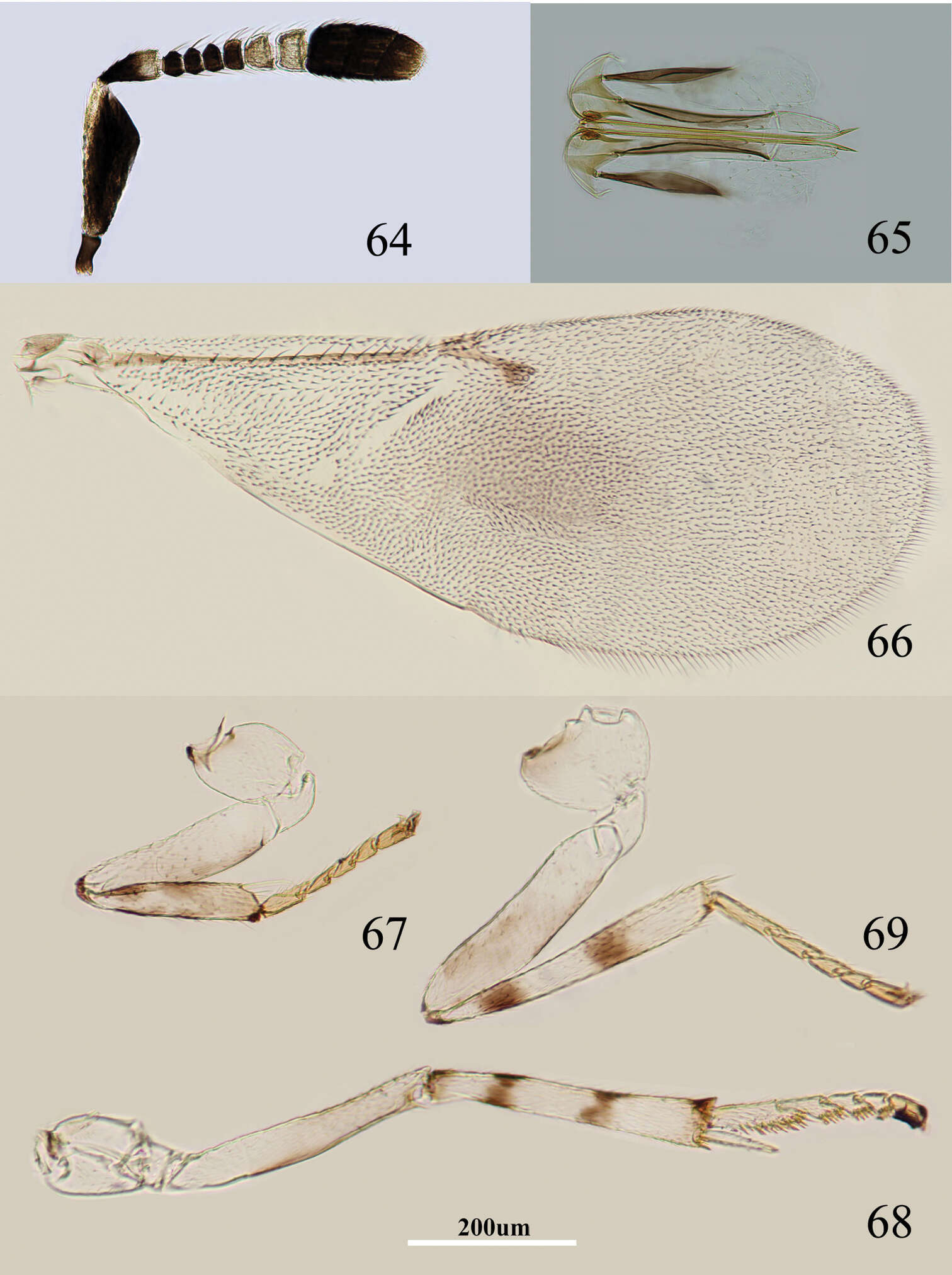 Imagem de Metaphycus deltoideus Wang, Li & Zhang 2014