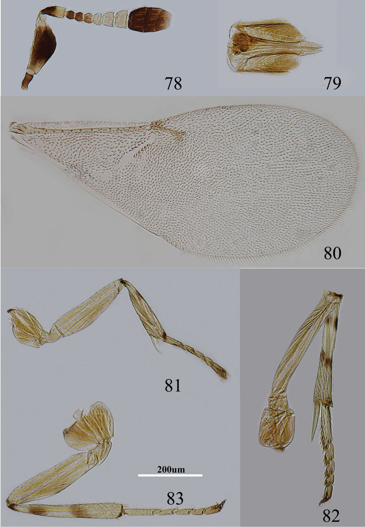 Image de Metaphycus insidiosus (Mercet 1921)