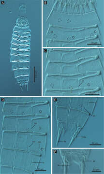 Image of Echinoderes hwiizaa Yamasaki & Fujimoto 2014