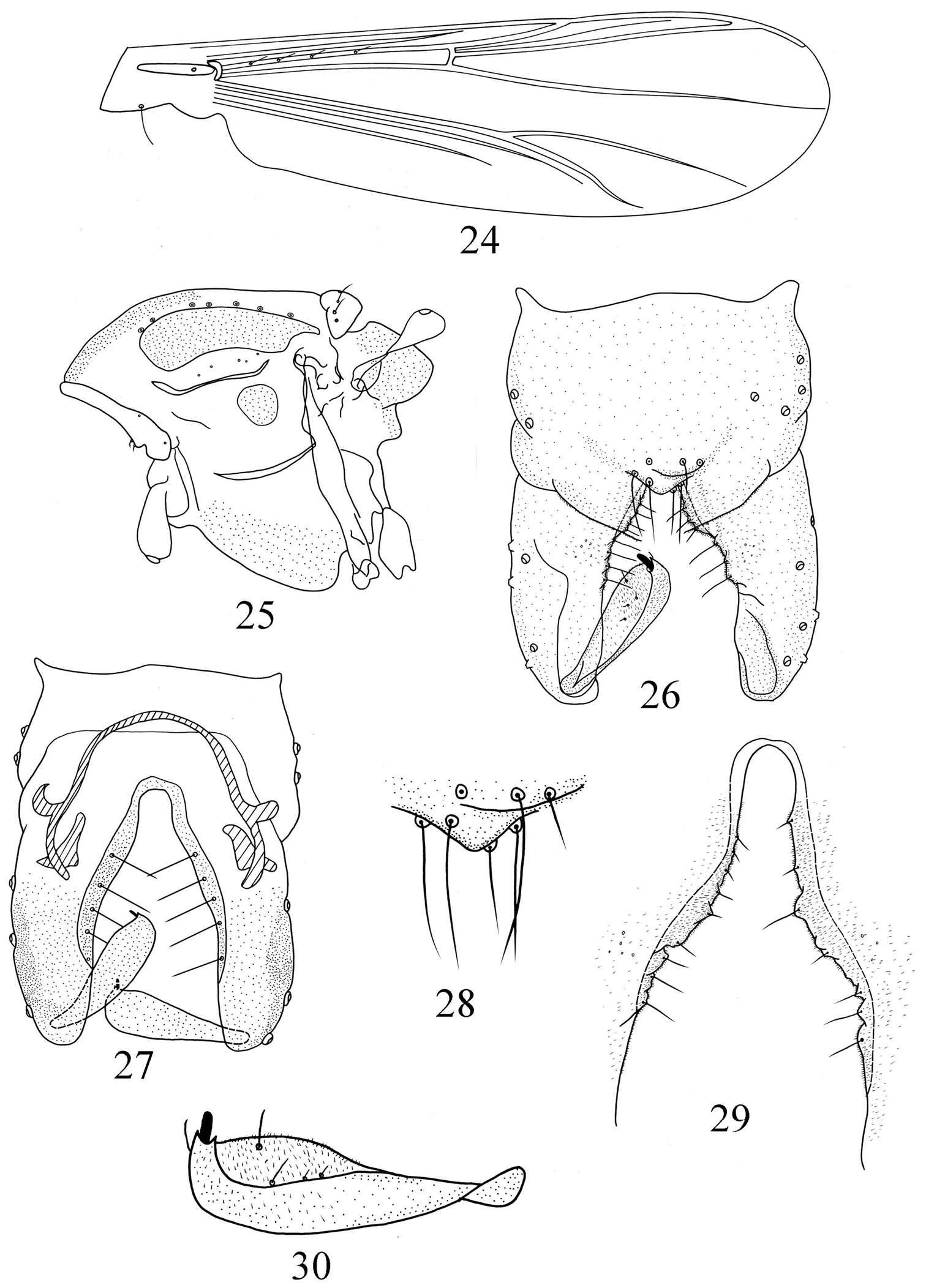 Imagem de Pseudorthocladius (Pseudorthocladius) paucus Ren, Lin & Wang 2014