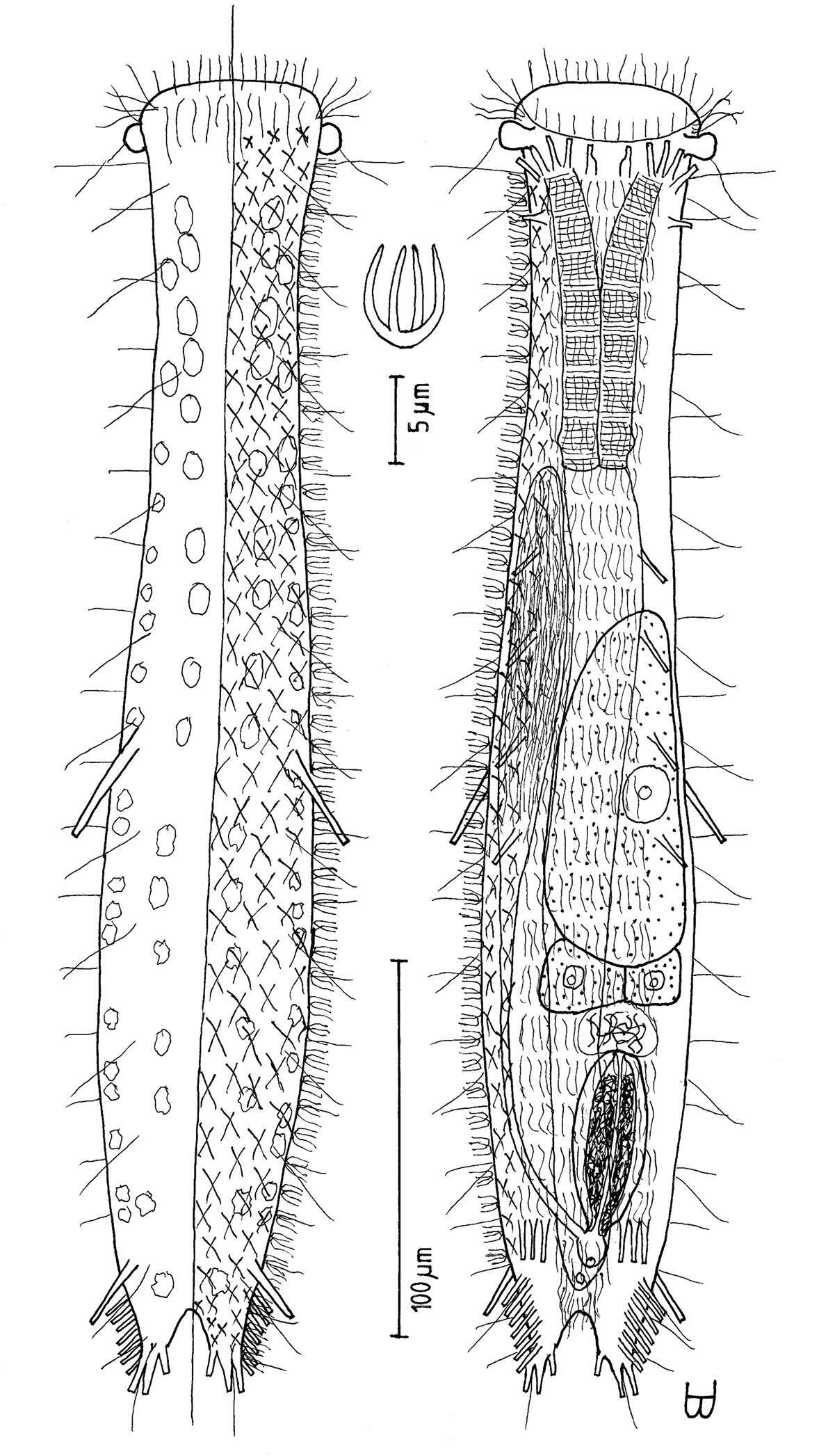 Image of Tetranchyroderma