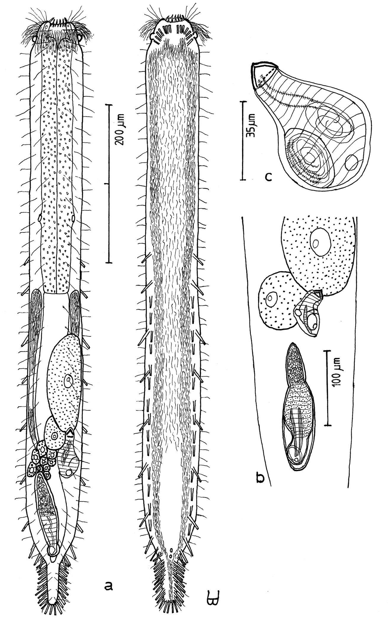 Plancia ëd Macrodasys scleracrus Hummon 2011