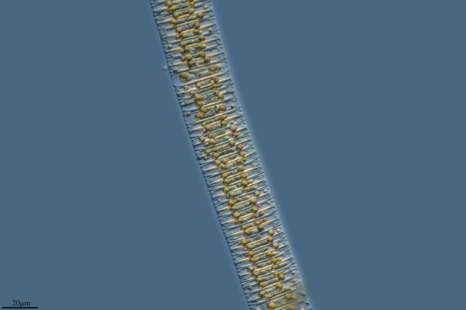 Sivun Fragilariales kuva