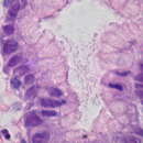 Sivun Helicobacter pylori kuva