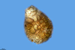 Image of Difflugia pyriformis