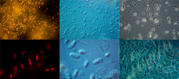 Image of Gloeobacteria