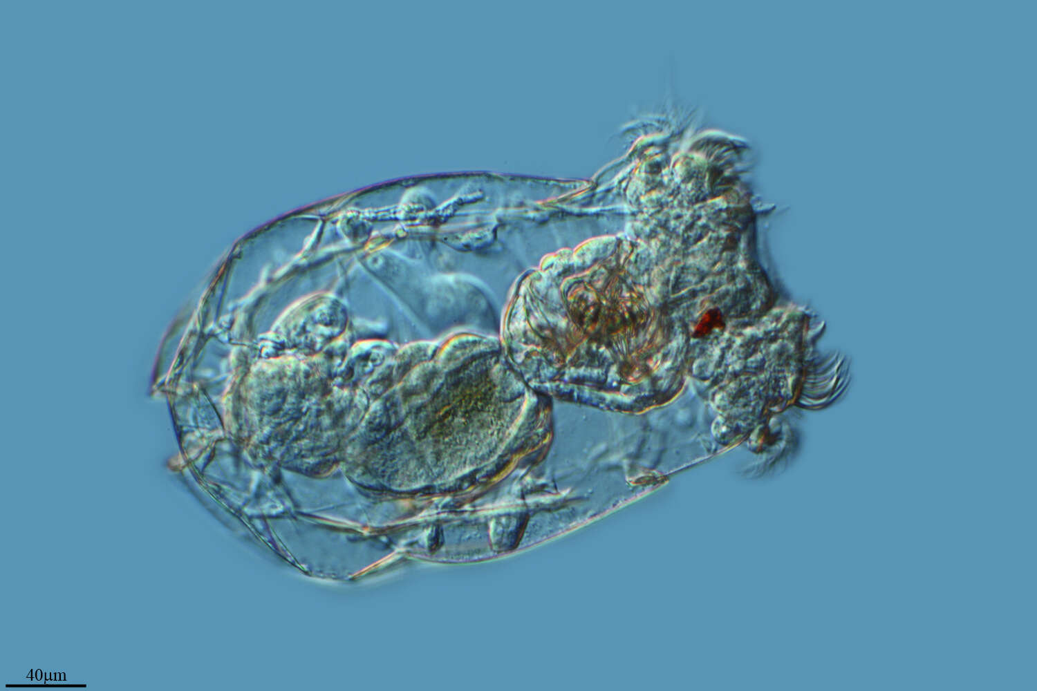 Image of Brachionus