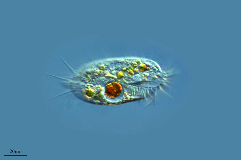 Image of Stylonychia pustulata