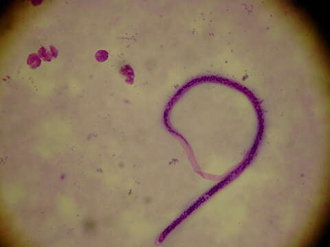 Image of nematodes