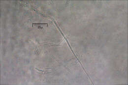 Image of Sordariomycetes