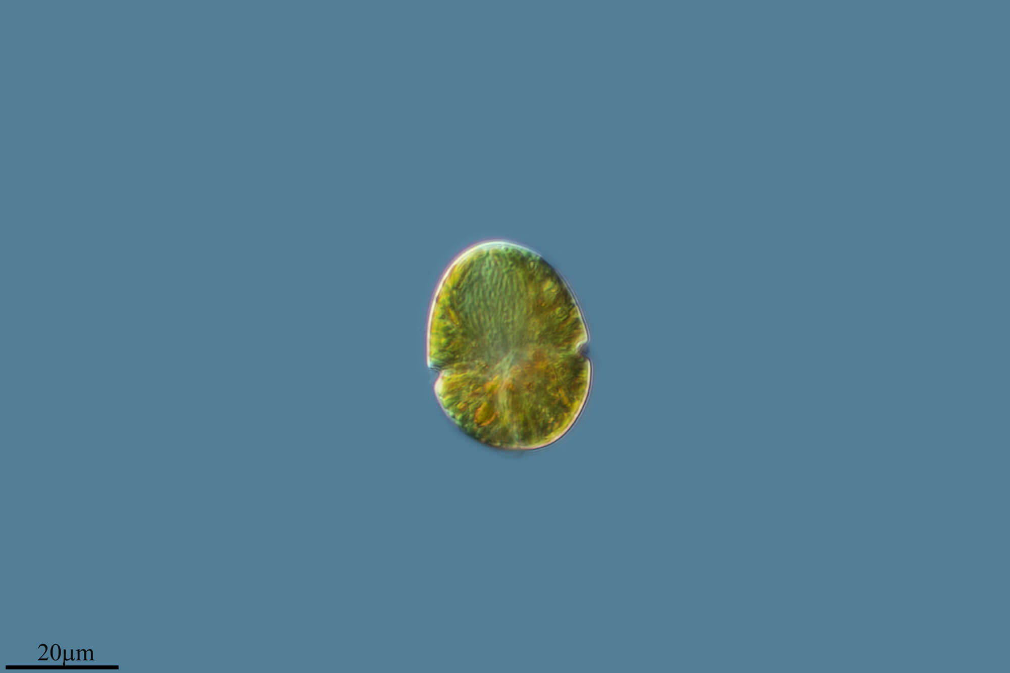 Image of Gymnodinium uberrimum (G. J. Allman) Kofoid & Swezy 1921