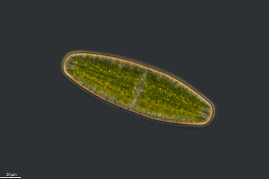 Image of Netrium digitus