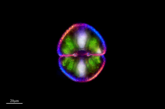 Image of Cosmarium botrytis