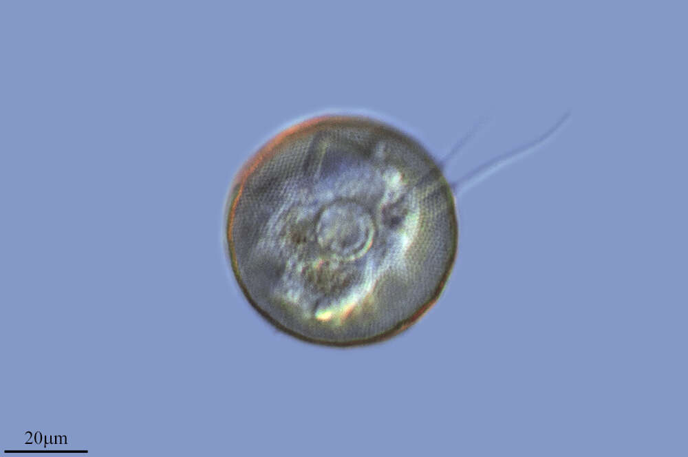 Imagem de Arcella vulgaris