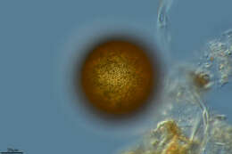 Image of Arcella vulgaris