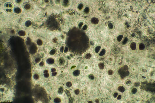 Image de Chroococcus ercegovicii Komárek & Anagnostidis 1994