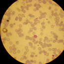 Image of Plasmodium vivax
