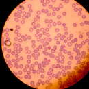 Image of Plasmodium malariae