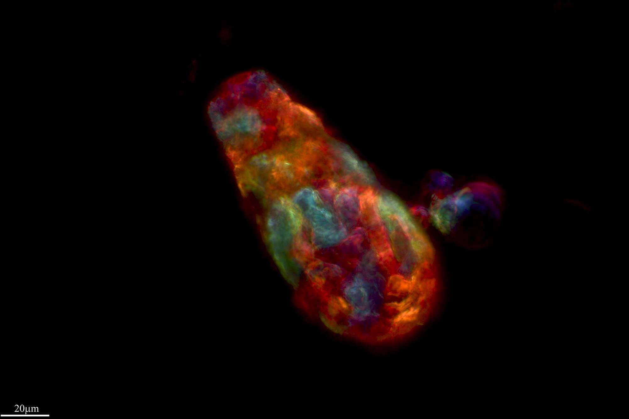 Image of Difflugia oblonga