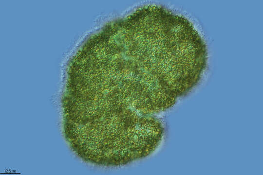 Microcystis botrys resmi