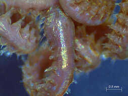 Image of segmented worms