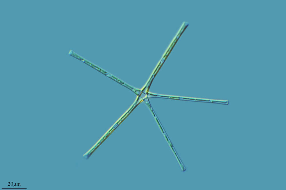 Image of Asterionella formosa