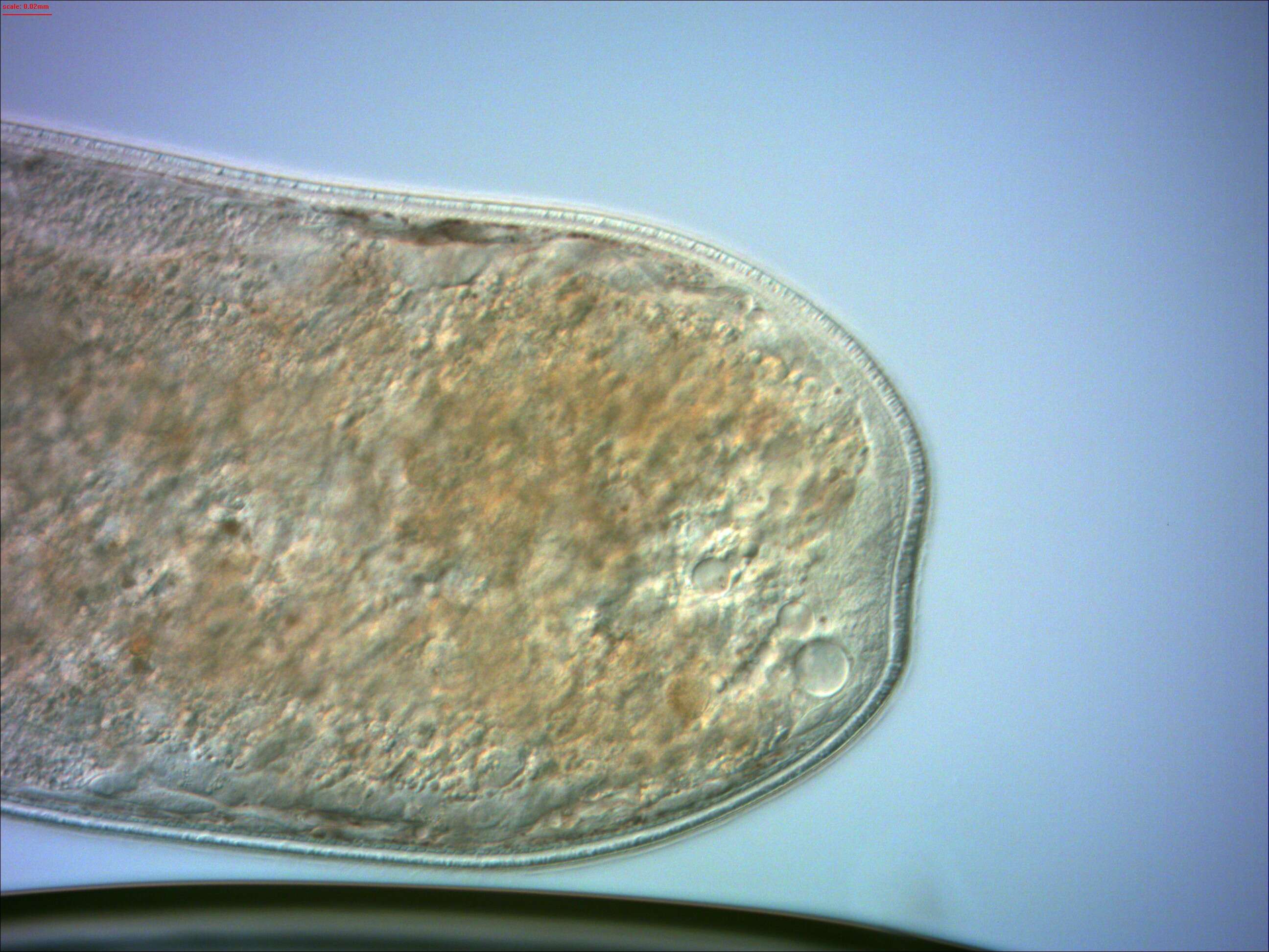Image of Opisthocystis