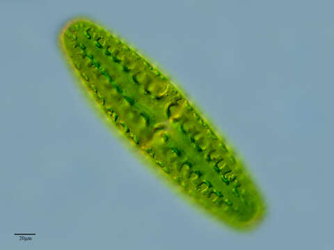 Image of Netrium digitus