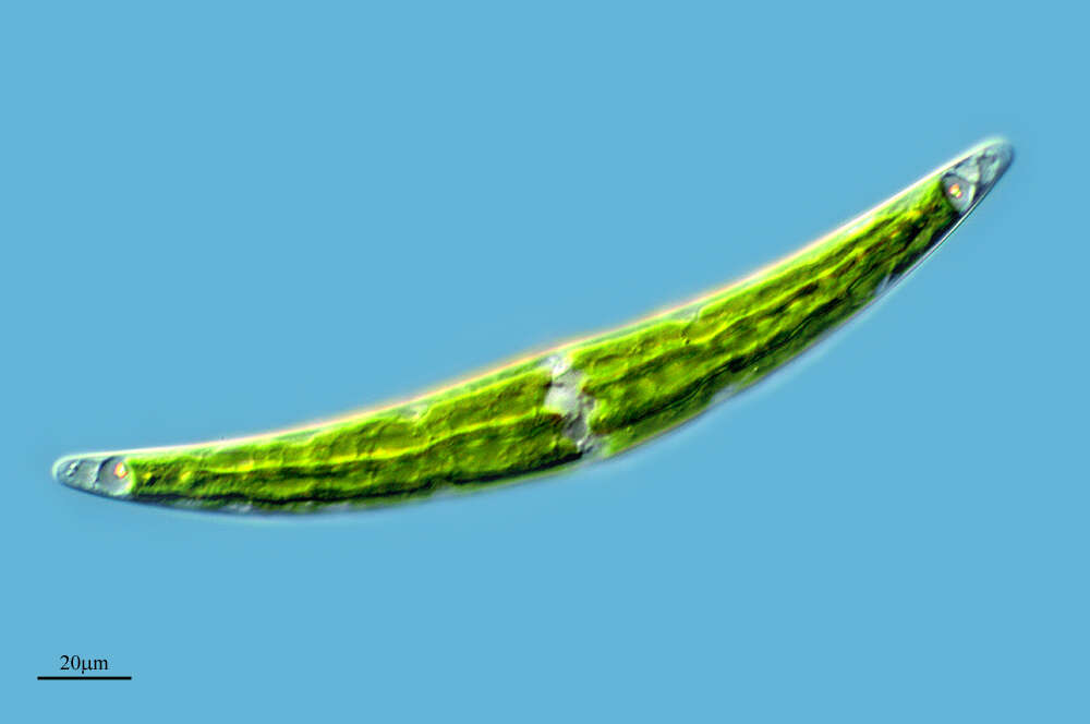 Image of Closterium moniliferum