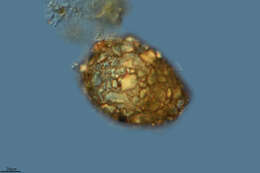Image of Difflugia pyriformis