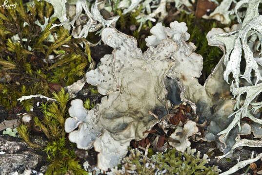 Image of lung lichen