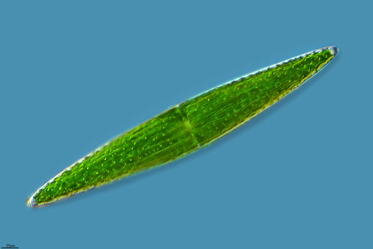 Image of Closterium lunula
