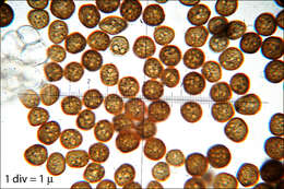 Image of Microbotryomycetes