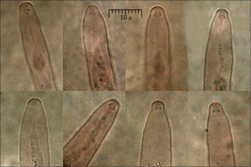 Eutypella quaternata (Pers.) Rappaz 1987 resmi