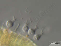 Image of choanoflagellates