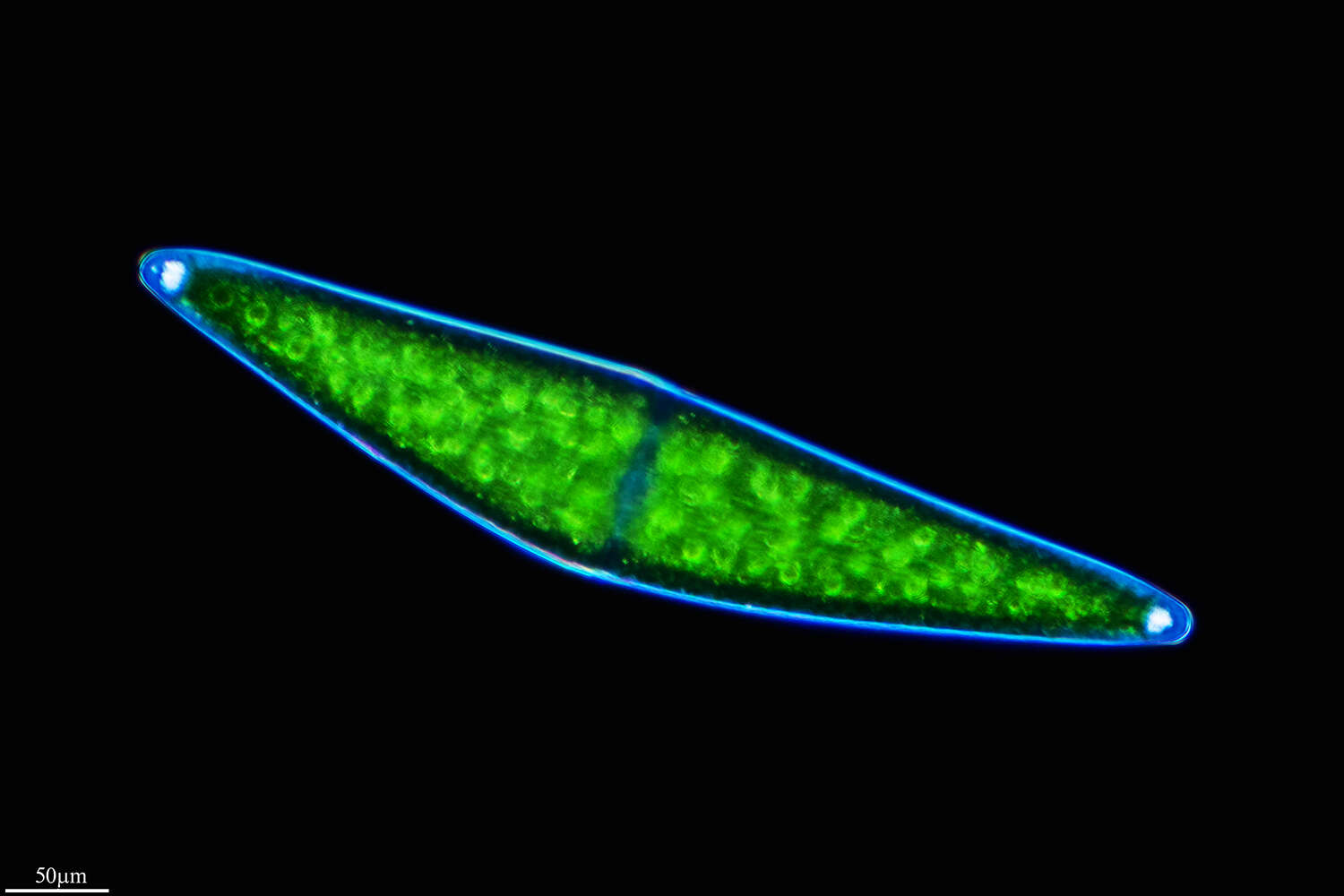 Image of Closterium lunula