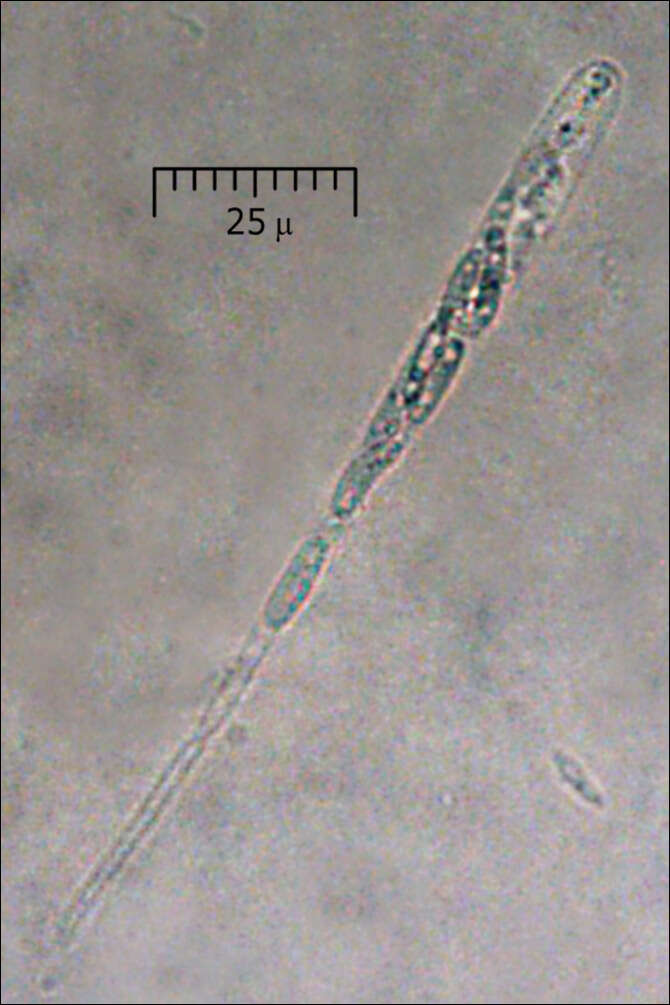 Image of Diatrypaceae