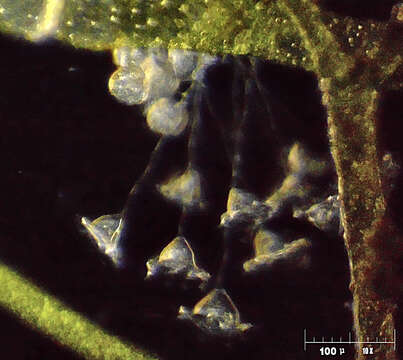 Vorticella campanula resmi