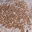 Image of Caloplaca erythrocarpa (Pers.) Zwackh