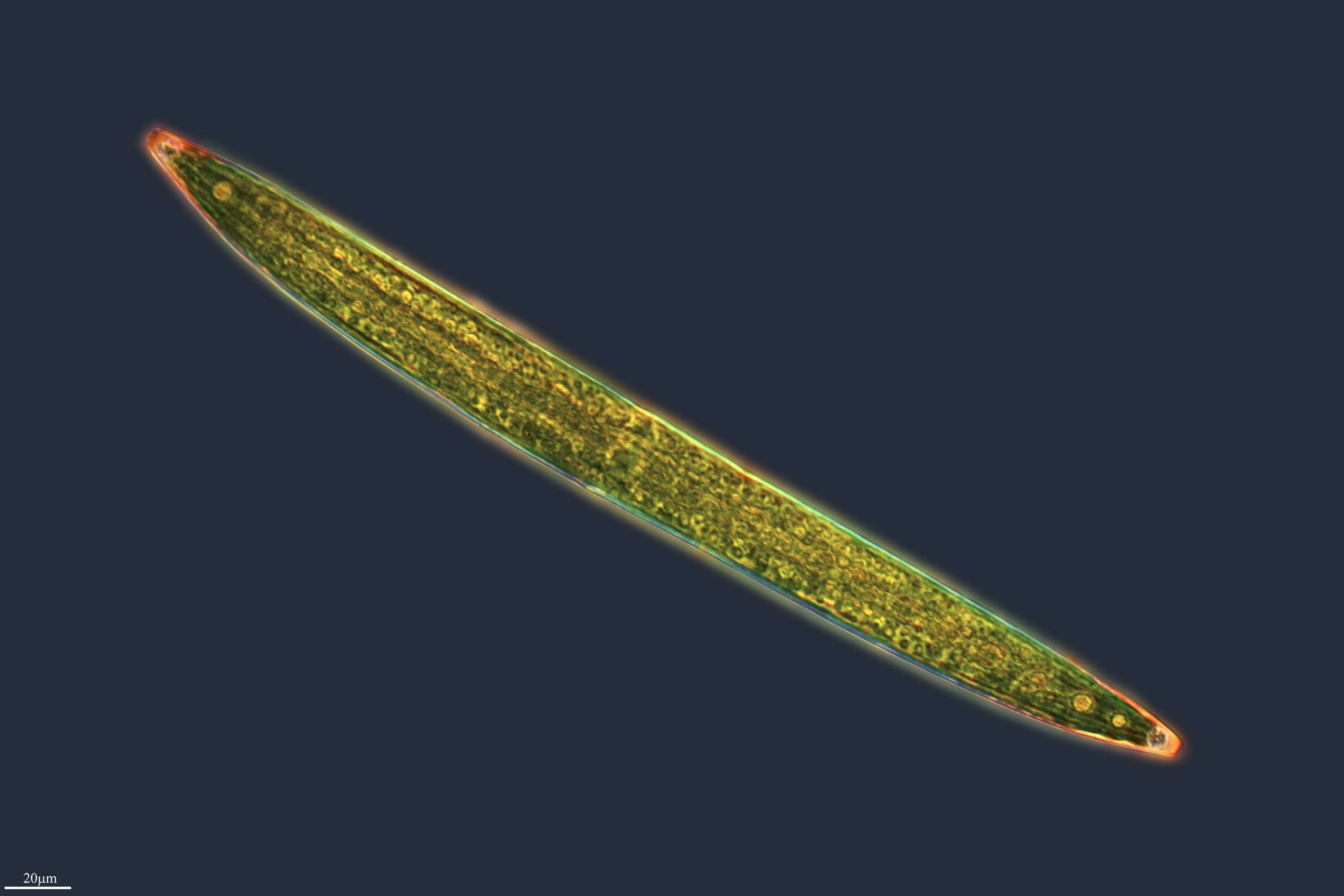 Image of Closterium acerosum