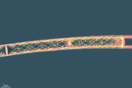 Image of Spirogyra XX