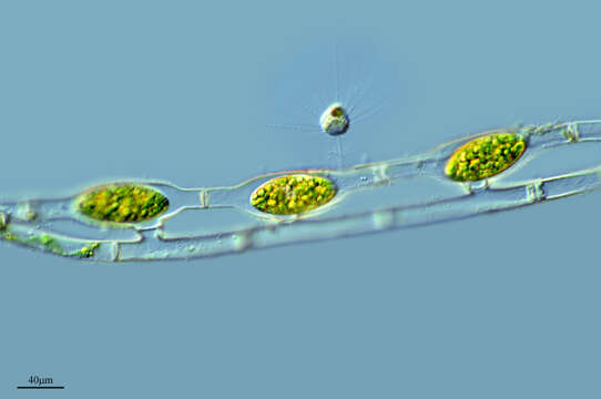 Image of Spirogyra weberi