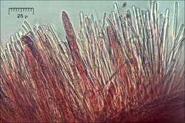 Image of Hyaloscyphaceae