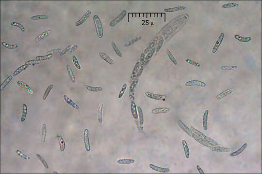 Image of Eutypella quaternata (Pers.) Rappaz 1987