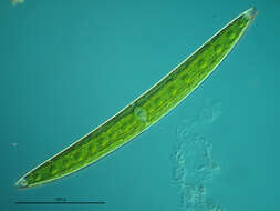 Image of Closterium moniliferum