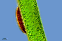 Image of Rophalodiacee